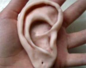Невидимый слуховой аппарат-имплант