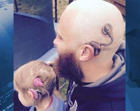 Австралиец набил на своей голове татуировку в виде речевого процессора кохлеарного импланта